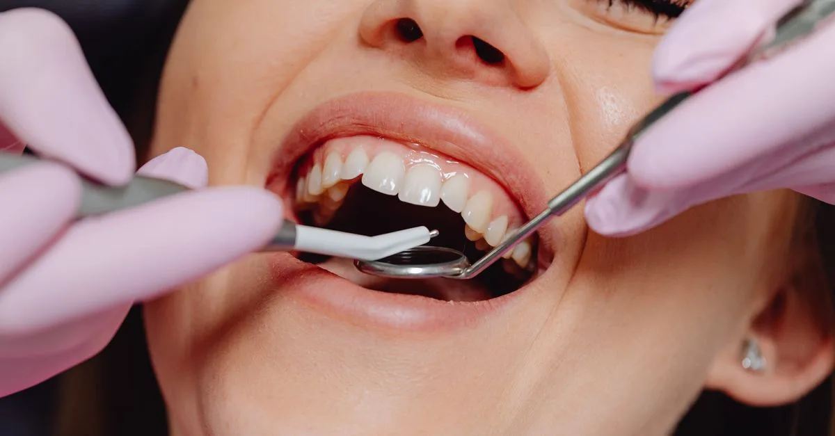 la gingivite est une inflammation des gencives causée par l'accumulation de plaque dentaire, entraînant rougeur, gonflement et saignements. découvrez ses symptômes, causes et traitements pour préserver votre santé bucco-dentaire.